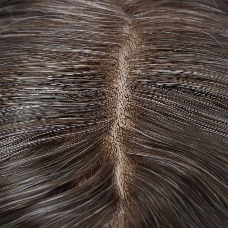 Super-thin-skin-hair-replacement-for-men